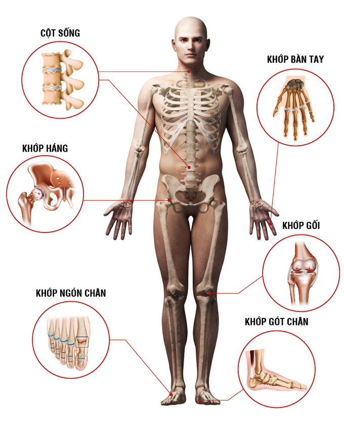 10 cách phòng ngừa thoái hóa xương khớp